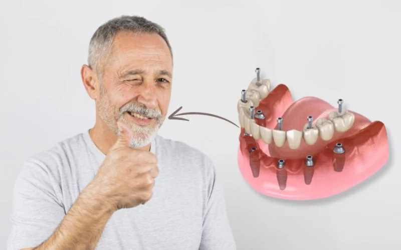 Full Mouth Rehabiliation